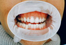 Why You Have Pale Gums?